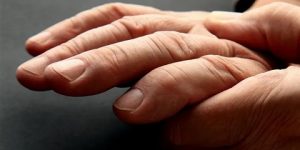 تورم الأصابع في الشتاء- كيف تتخلص منه؟