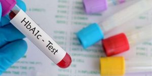 تحليل الهيموجلوبين- متى يجب إجرائه