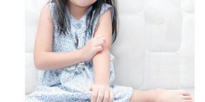 الصدفية.. مرض يصيب الأطفال والبالغين