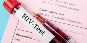 الإيدز … إحصائيات مخيفة !