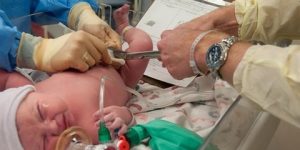 جديد الطب.. تأخير قص الحبل السري يسمح بتدفق مزيد من الدم للمولود