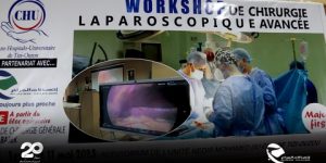 اتصالات الجزائر تضمن بث عمليات جراحية بتقنية التحاضر المرئي عن بعد