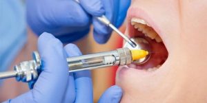 نحو توزيع 3 ملايين جرعة من مواد التخدير الخاصة بجراحة الأسنان في ظرف أسبوعين