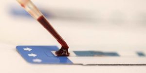 الفحص دقيق بنسبة 85 % في اكتشاف مصدر الورم.. اختبار دم للكشف عن سرطانات متعددة يُظهر نتائج واعدة