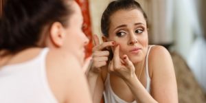 جمال وأناقة ..نصائح للتخلص من حب الشباب قبل الزفاف