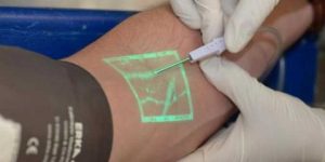 بشار.. تزويد مركز مكافحة السرطان بأجهزة كشف الأوردة الدموية بالأشعة تحت الحمراء