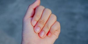 جمال وأناقة.. النقاط البيضاء في الأظافر مرآة صحتك