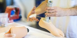 مع ضرورة توفير هذه الأعضاء الاصطناعية بالجزائر.. نداء للضمان الاجتماعي قصد التكفل بالمصابين بكسور الورك