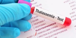 اضطرابات الهيموغلوبين… الموروثة منها أكثر شيوعاً
