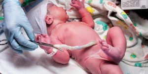 ما هو الوقت الأفضل لقطع الحبل السُرّي للمواليد الجدد