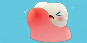 احذر – انتفاخ اللثة علامة على هذه الأمراض