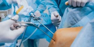 مشروع لتكوين جراحي عظام جزائريين حول جراحة المفاصل بالمنظار عن طريق المحاكاة