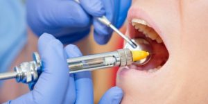 وزارة الصناعة تطرح  قرابة 7 ملايين جرعة لمواد تخذير الأسنان في السوق