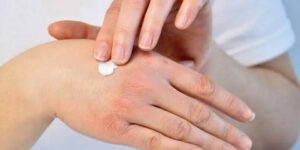 يكثر في فصل الشتاء.. جفاف جلد اليدين وتقشّره قد يشير لمشكلات طبية أساسية !