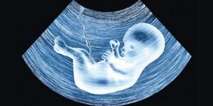 الطريق الصحيح لطفل سليم.. اختبارات الحمض النووي للتعرف على الأمراض الوراثية