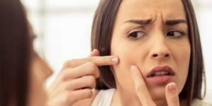 إذا كنت تعانين من البقع الداكنة.. 4 نصائح لإزالتها بشكل سريع