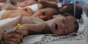 أكثر من 3500 طفل معرضون لخطر الموت التدريجي بغزة