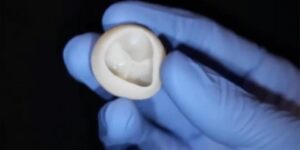 “طباعة” قلب من الكولاجين.. تحدي العلماء الجديد