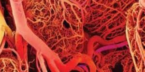 التهاب الشبكة العنكبوتية.. حالة قد تُعطل الحياة