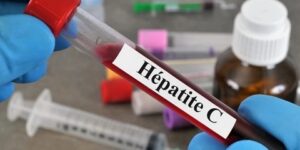 قسنطينة.. إطلاق حملة للكشف المبكر عن التهاب الكبد الفيروسي “ج”