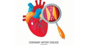 المرأة و”متلازمة إكس”… وهم نفسي أم مرض قلبي؟