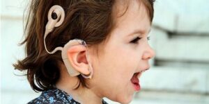 بعد زراعة قوقعة الأذن.. أهم الطرق لتطوير مهارات الاستماع