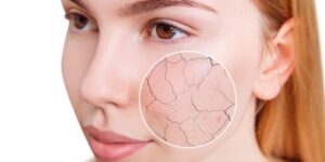 عناية يومية لنتيجة ناعمة.. نصائح الخبراء للتعامل مع البشرة الجافة