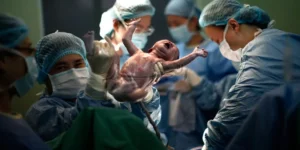 الولادة القيصرية.. أصبحت خيارا للكثيرات