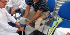 مويدي: أزيد من 100 ألف مستفيد سنويا من الأعضاء الاصطناعية في الجزائر