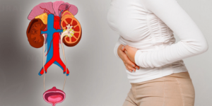 تُصيب 60 % من النساء.. حقائق طبية هامة عن التهابات المسالك البولية