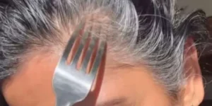 تمشيط الشعر بشوكة الطعام.. هل هي مُثبتة علميا؟