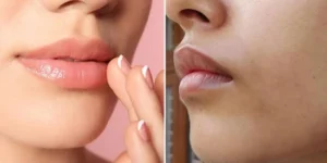 السواد حول الشفاه.. كيف تتخلصين منه منزليا؟