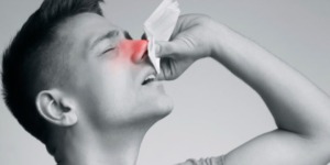 نزيف الأنف المتكرر.. قد يُشير للإصابة ببعض الأمراض