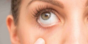 يجب الحذر منها.. مشكلة مزعجة قد تصيب العينين أثناء الصيام