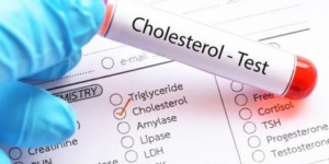 دراسة حديثة تكشف.. الأدوية الخافضة للكولسترول قد تقلل الخرف