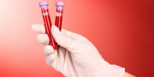 هذان المرضان يشكلان خطرا على صحة الدم