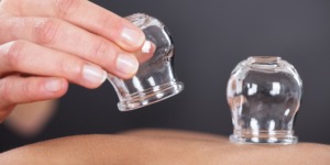 فوائد الحجامة