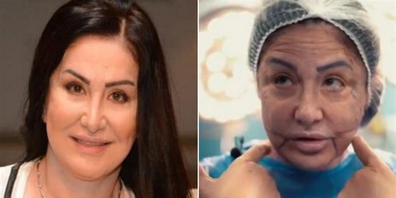 وفاء سالم تكشف تفاصيل تشوه وجهها بسبب خطأ طبي