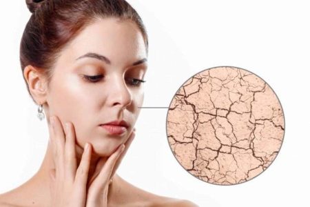 علامات تحذيرية لجفاف بشرة وجه