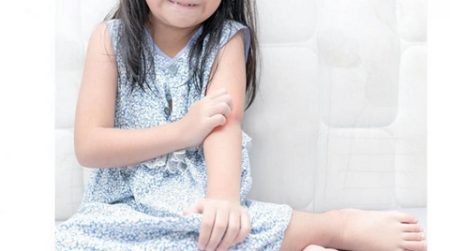 الصدفية.. مرض يصيب الأطفال والبالغين