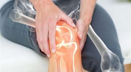 هشاشة العظام.. عوامل الإصابة ووسائل الوقاية