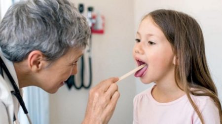 استئصال اللوزتين… فوائد ومخاطر