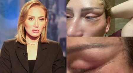ريهام سعيد تبتعد عن الشاشة بسبب تشوّه وجهها