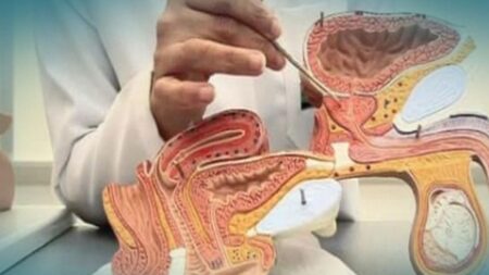 التهاب المثانة.. مرض ينشط خلال فصل الصيف