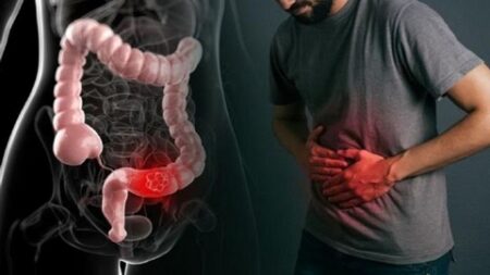 يكون خطيرا في بعض الحالات.. أعراض الإمساك التي ينبغي الانتباه لها