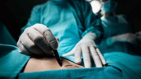 عمليات نحت القوام.. هل الغرض منها التجميل أم تجاوز ذلك؟