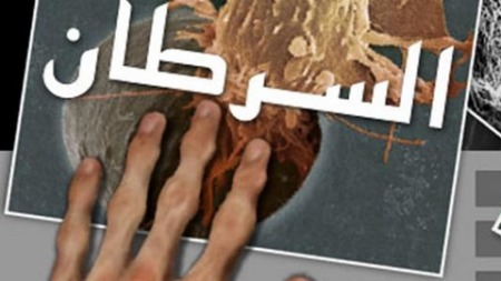 حقائق يجب أن تعلمها.. أبرز الأسئلة الشائعة حول مرض السرطان؟