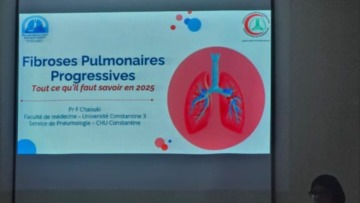 الجزائر تحتضن فعاليات الملتقى الأول للجمعية العربية لأخصائيي الأمراض الصدرية