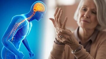 مرض باركنسون في الجزائر.. معاناة صامتة وتحديات يومية في غياب التوعية