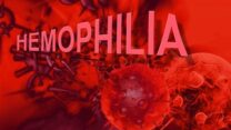 صورة معبرة عن الهيموفيليا في الجزائر..  التوعية أول الطريق نحو التكفل